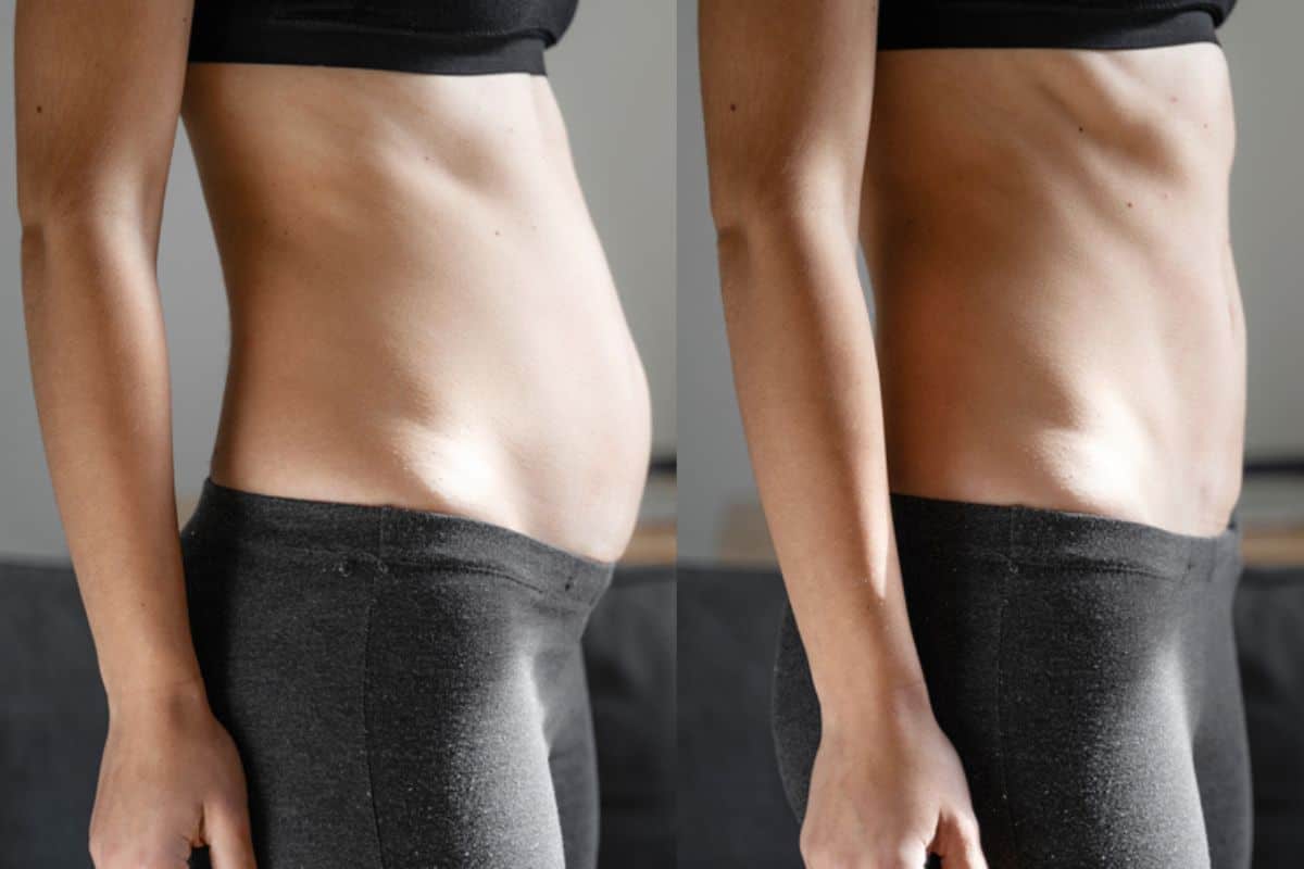 Post-Pregnancy: What Happens to Your Abdominal Muscles After Birth Redbourn