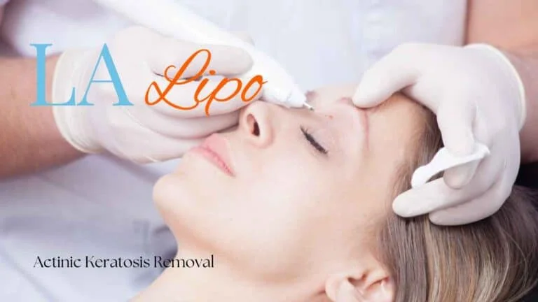 Woman receiving Actinic Keratosis Removal Treatment Redbourn