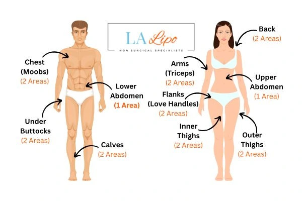 LA LIPO Cryolipolysis Areas Redbourn