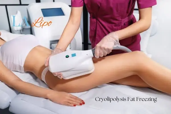 Woman receiving coolsculpting Redbourn treatment on her thighs
