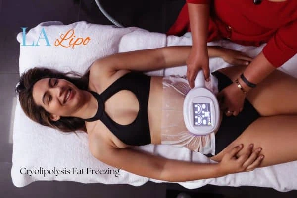 woman getting cryolipolysis Redbourn