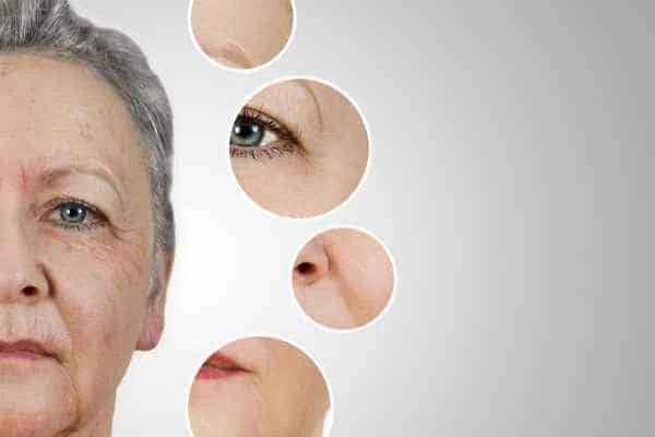 HIFU Facelift Redbourn from LA LIPO