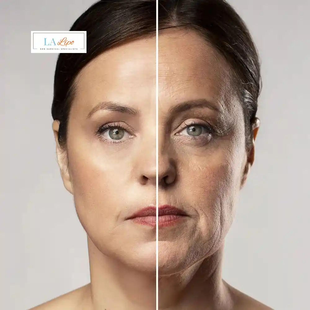 How Can You Tell If Non-Surgical Skin Tightening Is Right for You Redbourn?