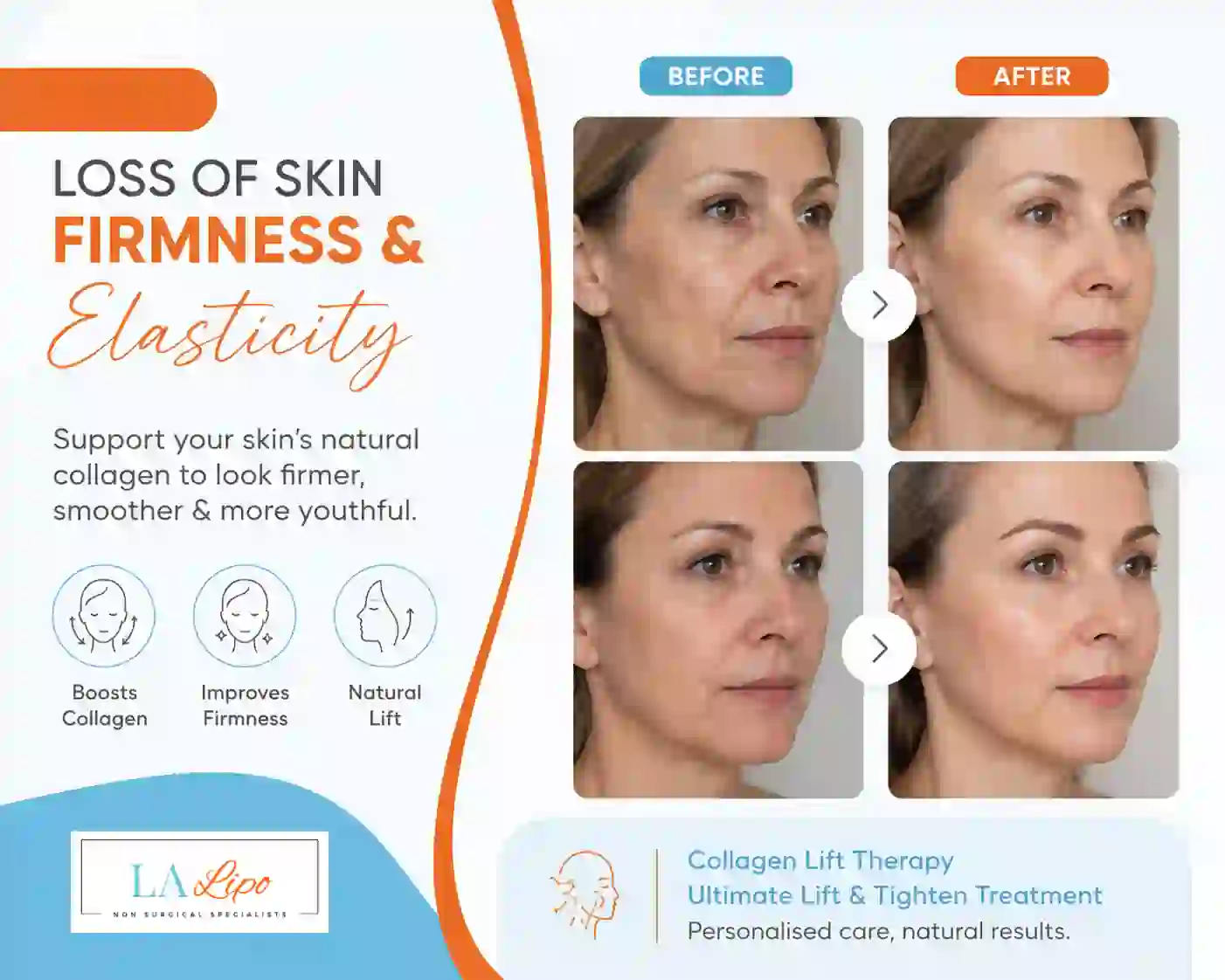 Sign #7: Loss of Skin Firmness and Elasticity Redbourn